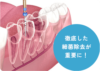 徹底した細菌除去が重要に！