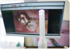 ペン型口腔内カメラ