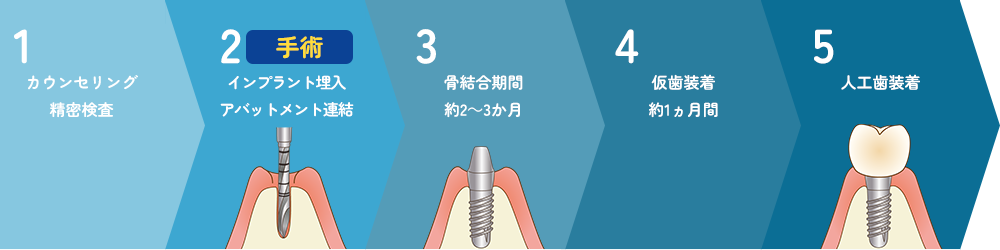 当院のインプラントの治療の流れ 1回法